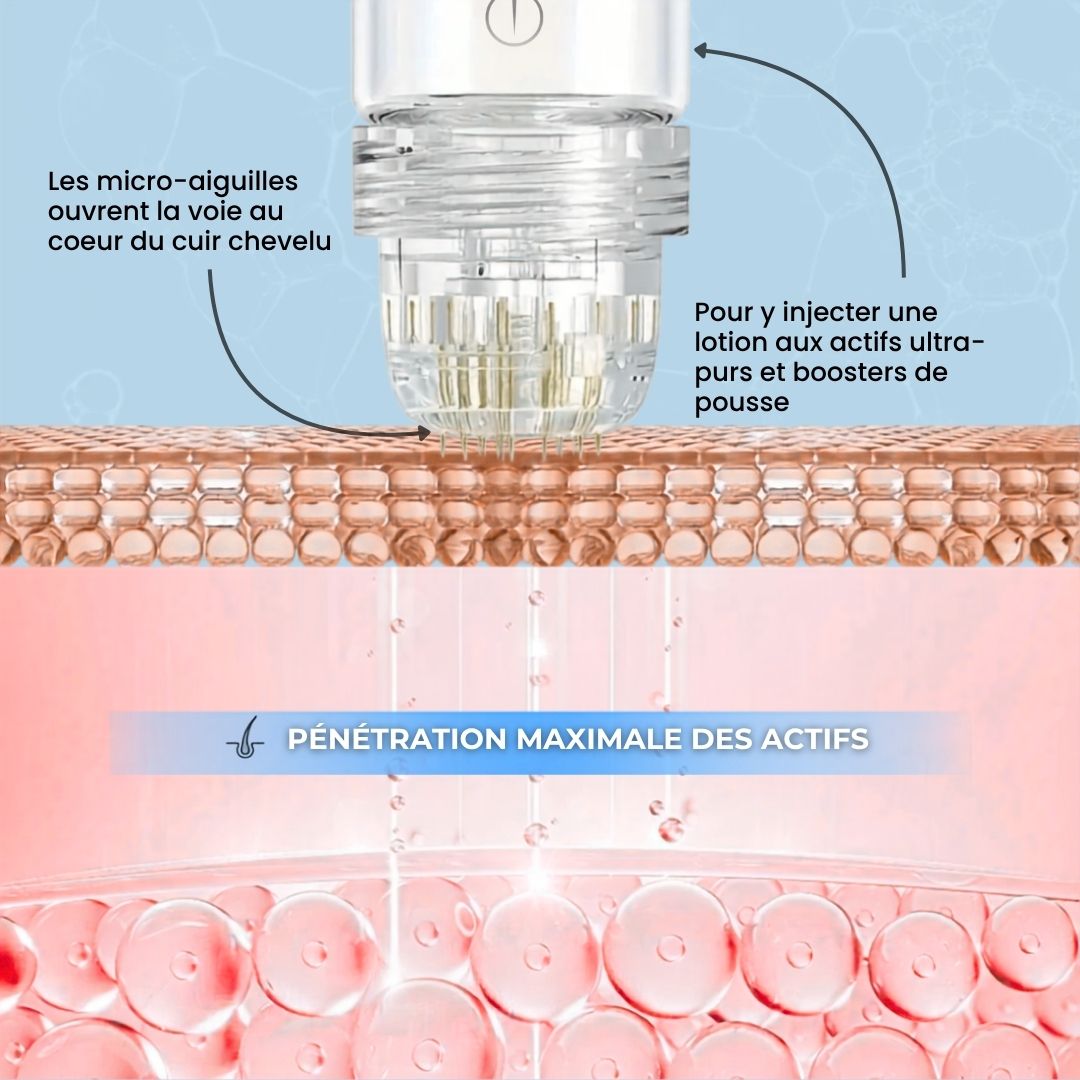 Kit Micro-Infusion Capillaire — Anti-chute & Repousse
